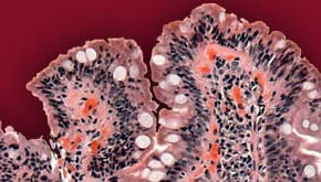 Links to Celiac Disease category of lessons.